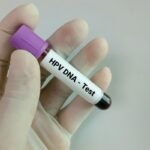 HPV DNA Self