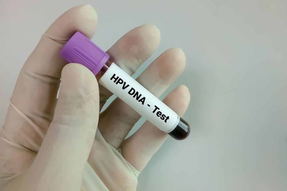 HPV DNA Self