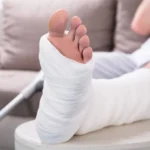 Pengobatan Patah Tulang yang Tepat, dari Pertolongan Awal hingga Rehabilitasi